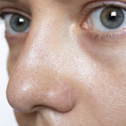 Routine beauté Peau grasse